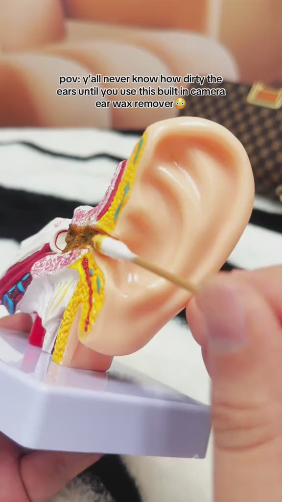Smart Visual Ear Cleaner – HD Camera & LED Light (WiFi Connected)